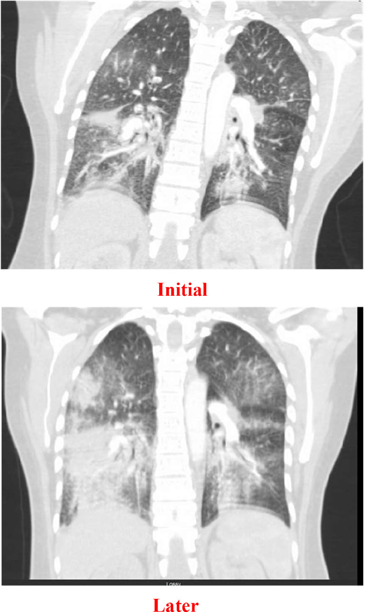 Fig 2: