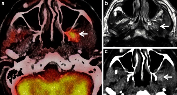 Fig. 9