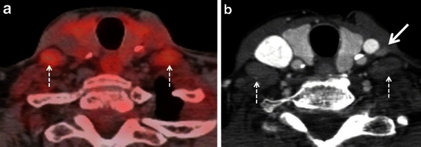 Fig. 15