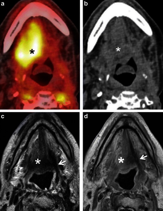 Fig. 10