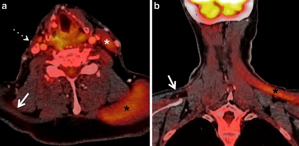 Fig. 12