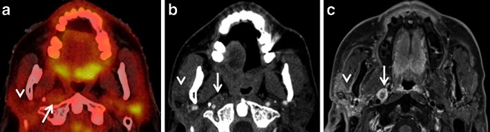 Fig. 14