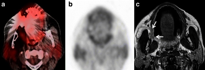 Fig. 18