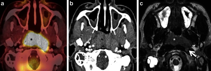 Fig. 17