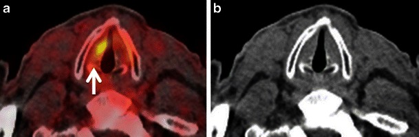 Fig. 11