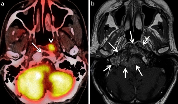 Fig. 16