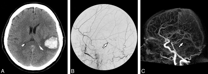 Fig 1.