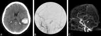 Fig 1.