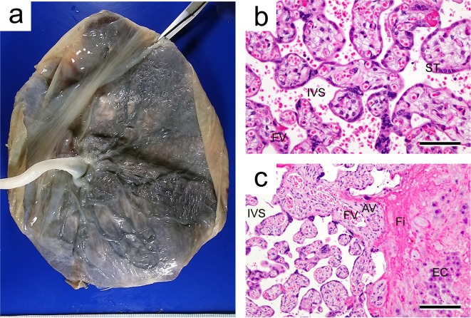 Fig. 12.