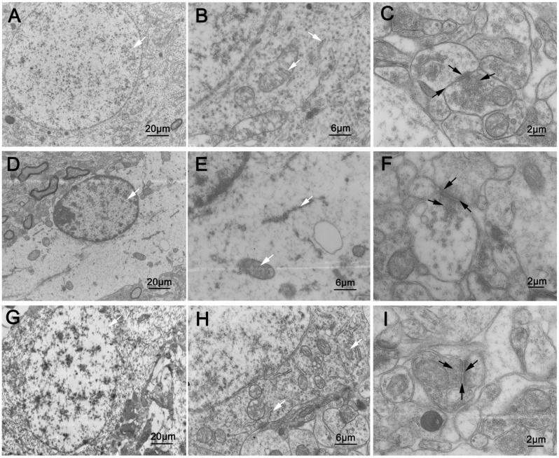 Fig. (2)