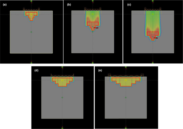Fig. 2