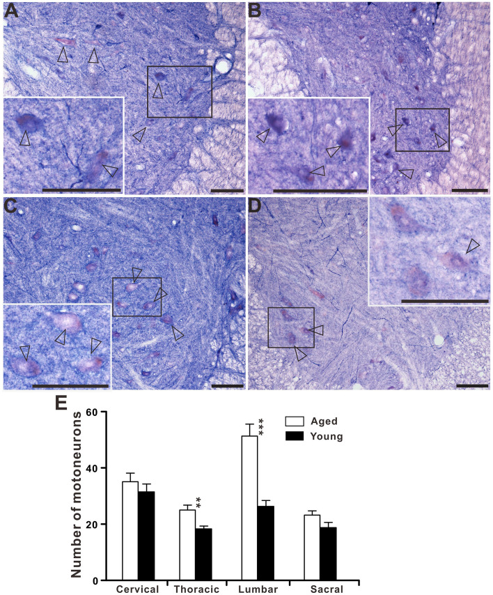 Figure 14