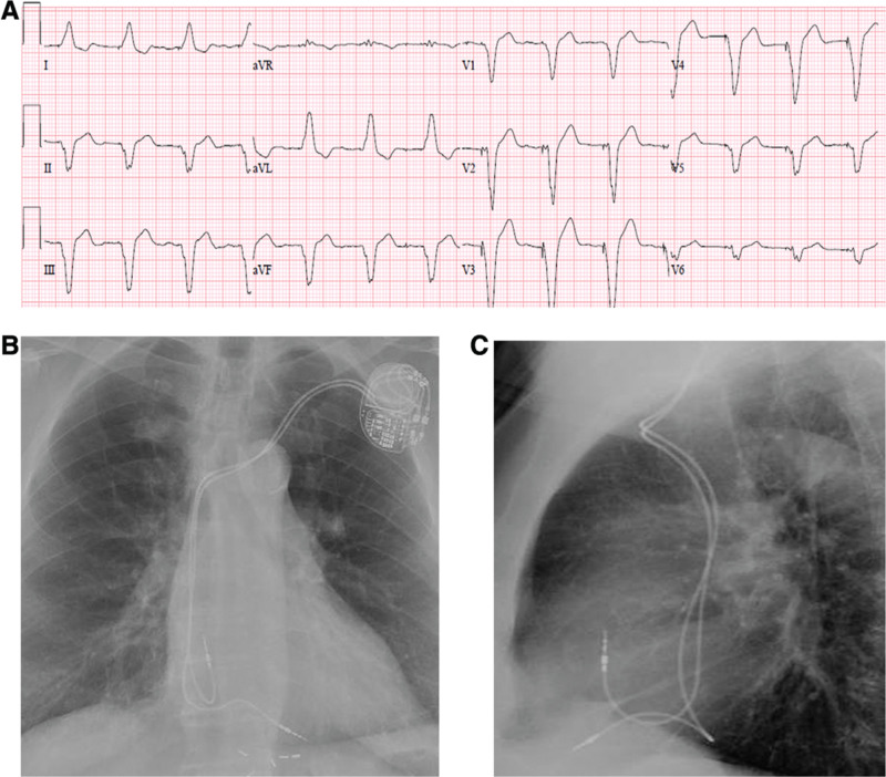 Figure 3: