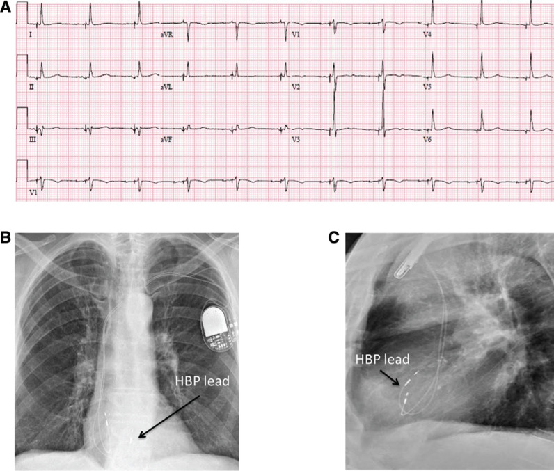 Figure 4: