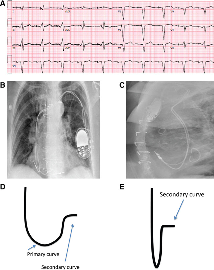 Figure 2: