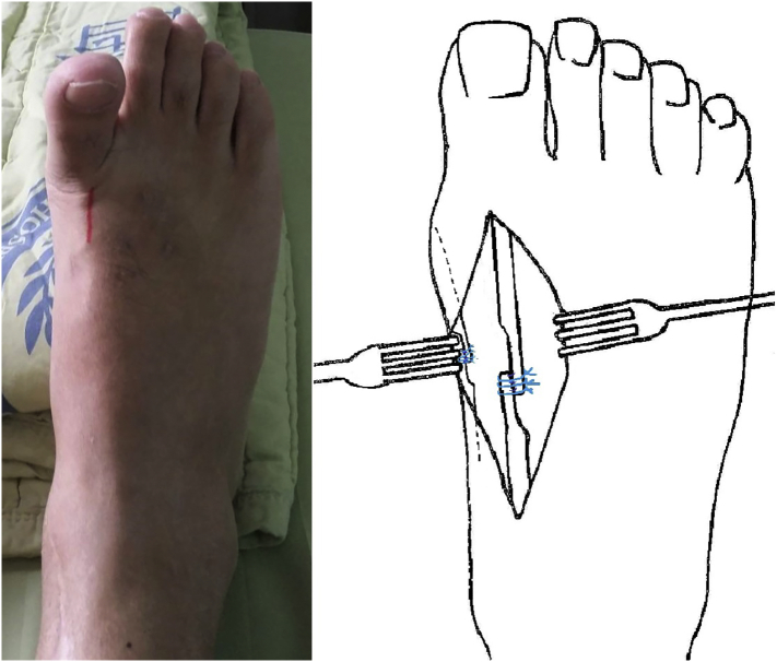 Fig. 3