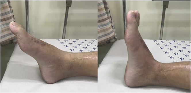 Fig. 4