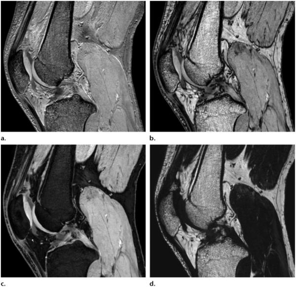 Figure 19