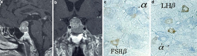 Fig. 12