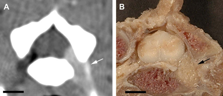 Fig 1.