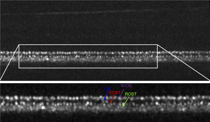 Fig 2