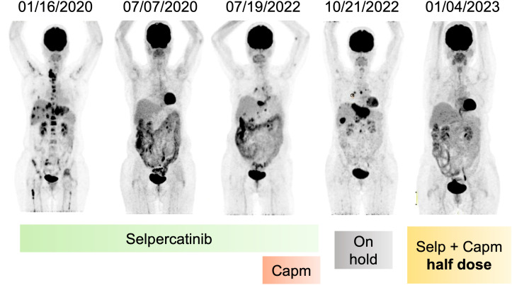 Figure 2