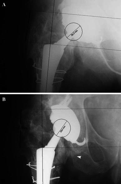 Fig. 4