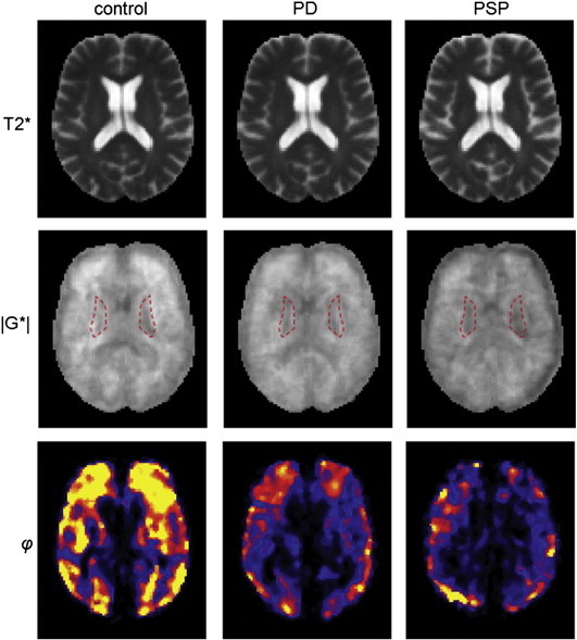 Fig. 2