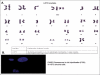 Figure 1a