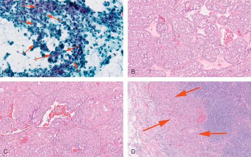 FIGURE 1