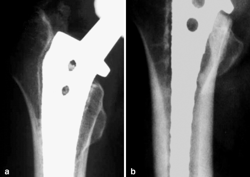 Fig. 4a, b