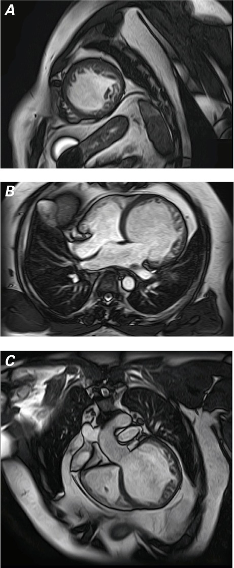 Fig. 2.