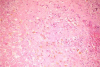 Figure 4b: