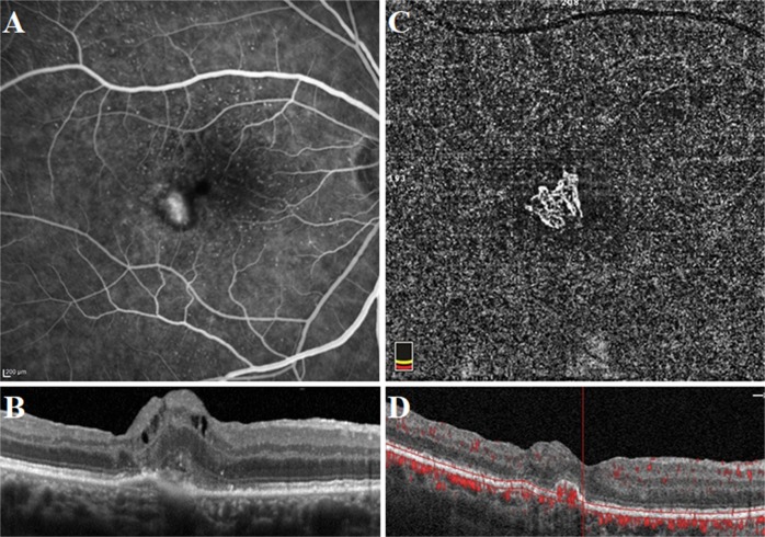 Fig. 4