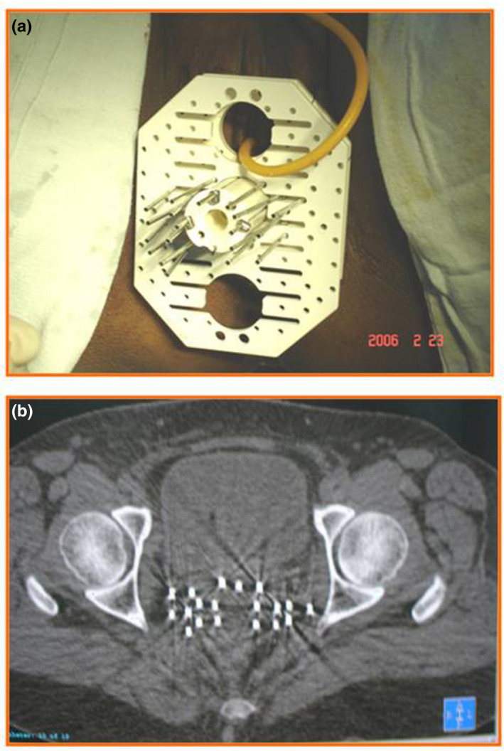 FIGURE 2