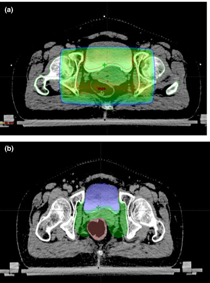 FIGURE 1