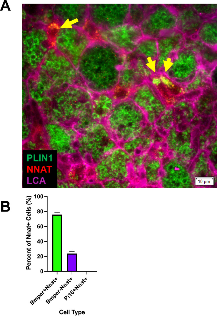 Figure 4—figure supplement 1.