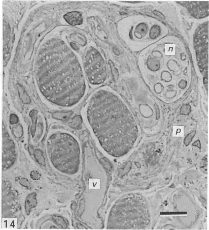 Fig. 14