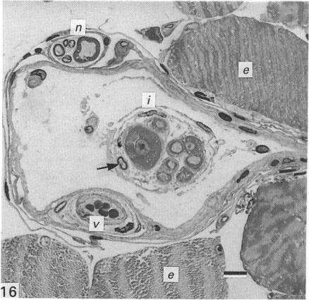 Fig. 16