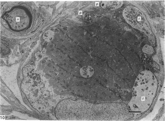 Fig. 10