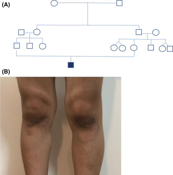 FIGURE 2