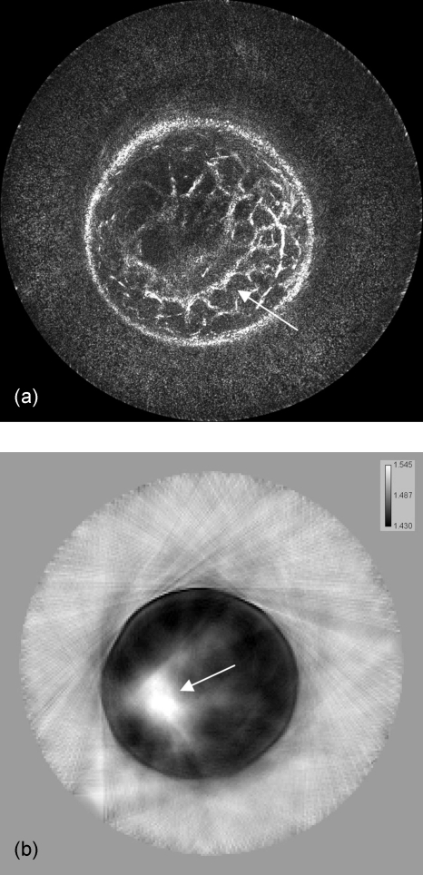 Figure 14