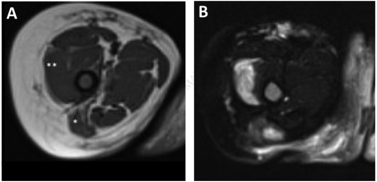 FIG E1.