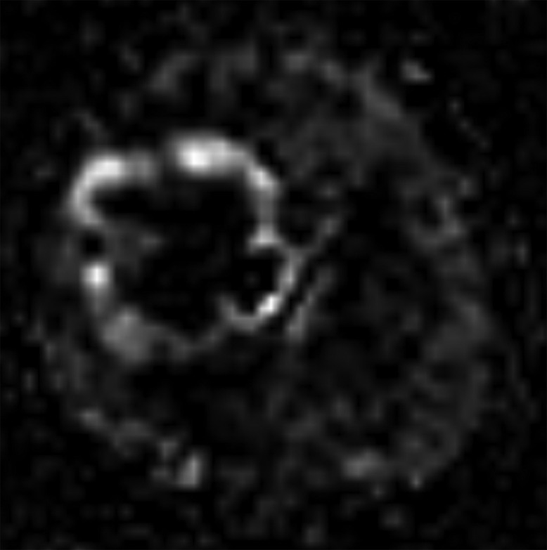 Fig 3