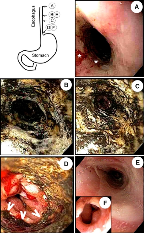 Fig. 1