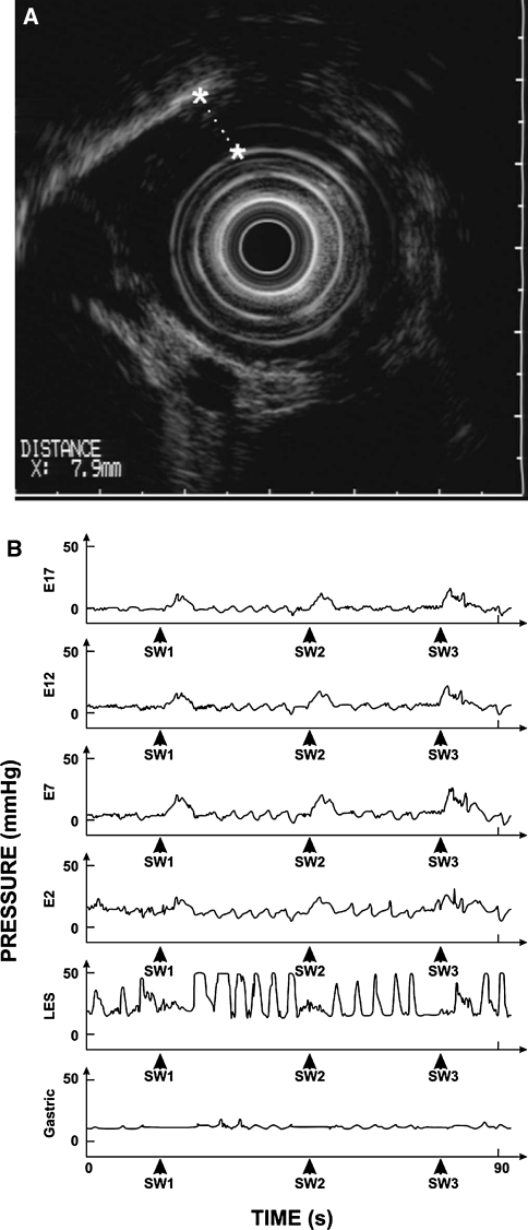 Fig. 2