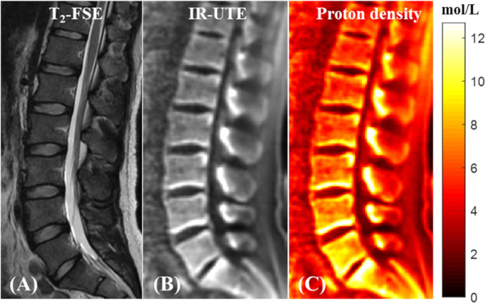 Figure 12