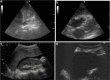 Fig. 2