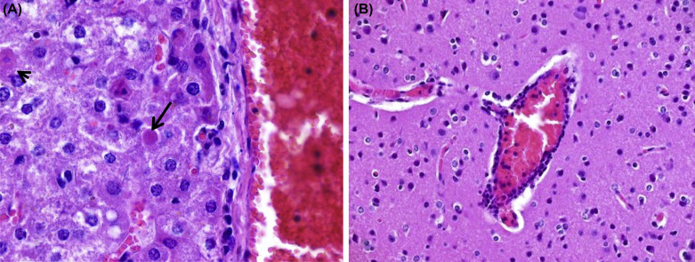Figure 15.6