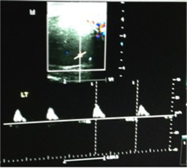 Figure 2: